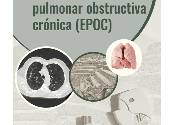 El A,B y E de la enfermedad pulmonar obstructiva crónica (EPOC)