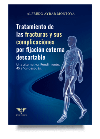 Tratamiento de las fracturas y sus complicaciones por fijación externa descartable (Alfredo Aybar Montoya)