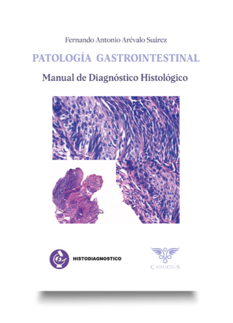 Patología gastrointestinal. Manual de diagnóstico Histológico (Fernando Antonio Arévalo Suárez)| Guía completa para diagnóstico”