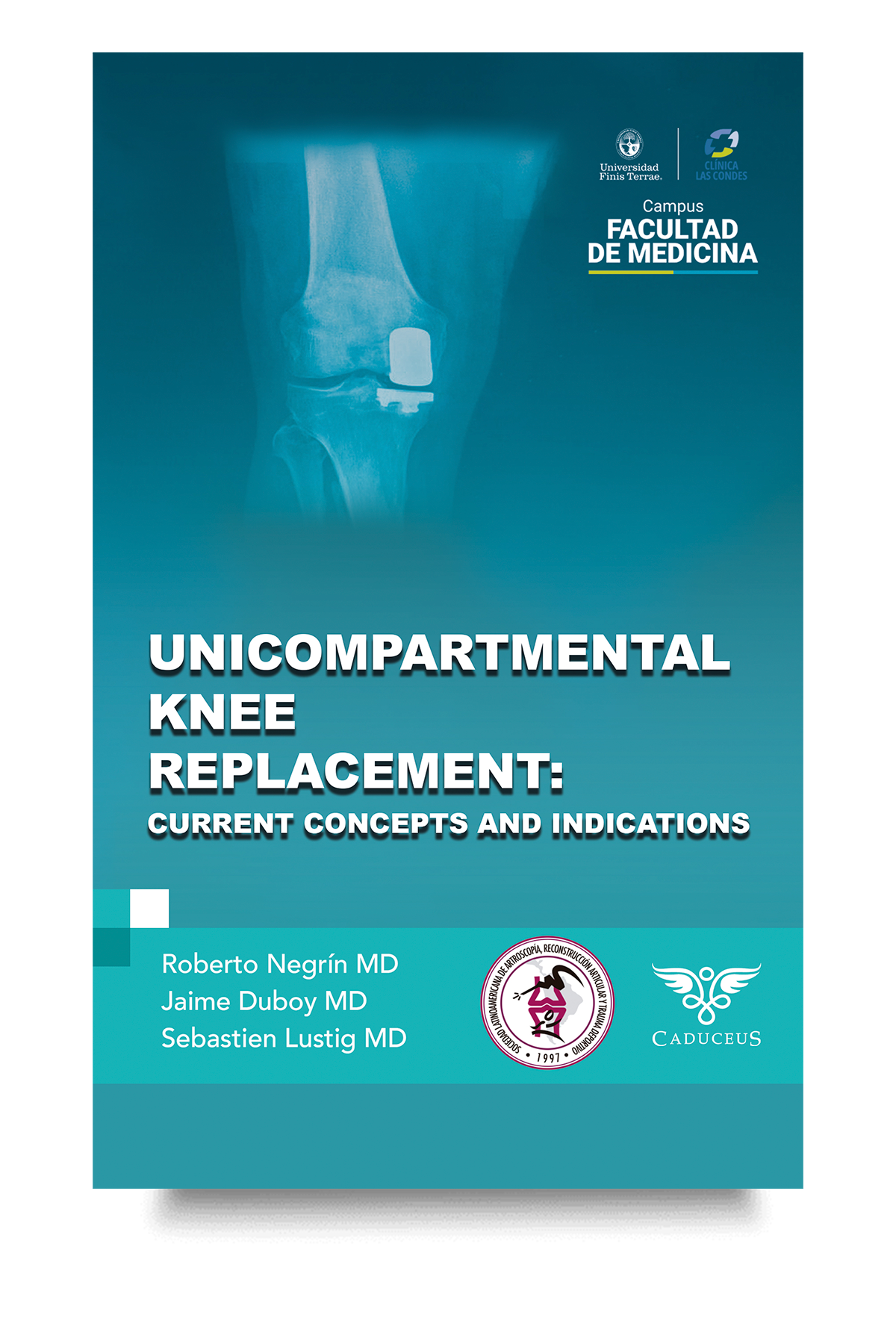 Advanced concepts in partial knee replacement surgery Medical book on partial knee replacement techniques